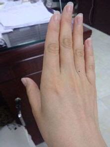 無名指有痣 左手